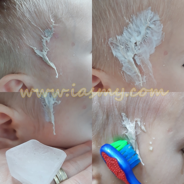 guma de mestecat din părul copilului